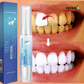 STAINLIFT Powerful Teeth Stain Removal